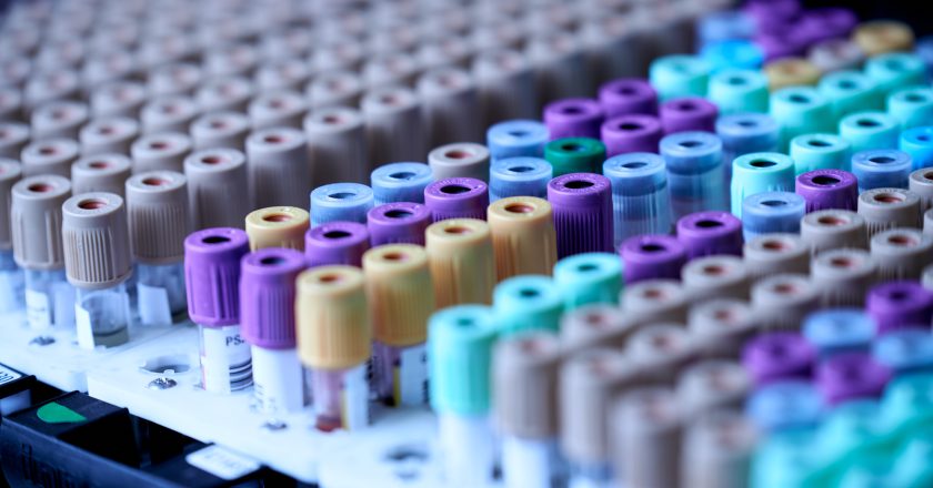 Dubai to Launch First Robotic Biobank